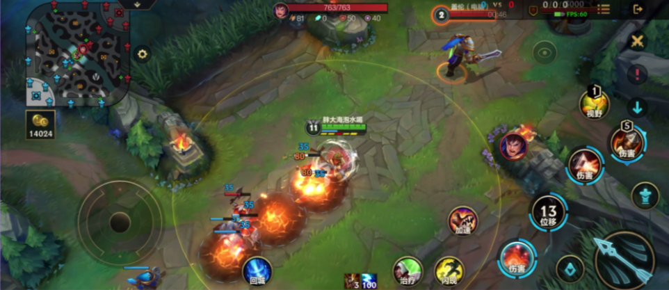 英雄联盟手游英勇投弹手如何出装